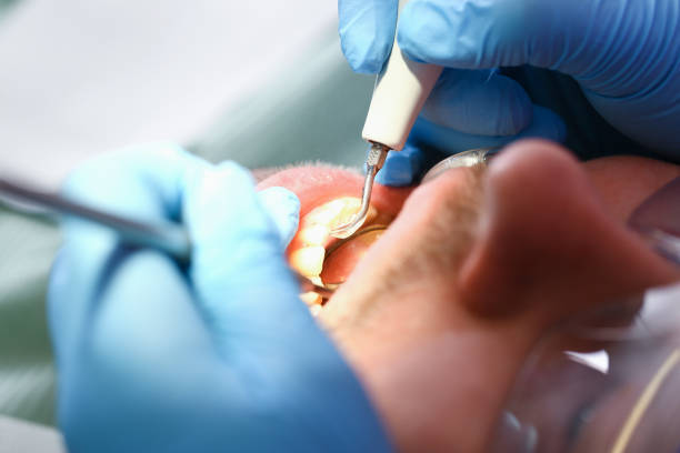 Best Emergency Treatment for Toothache in Bellevue, WI